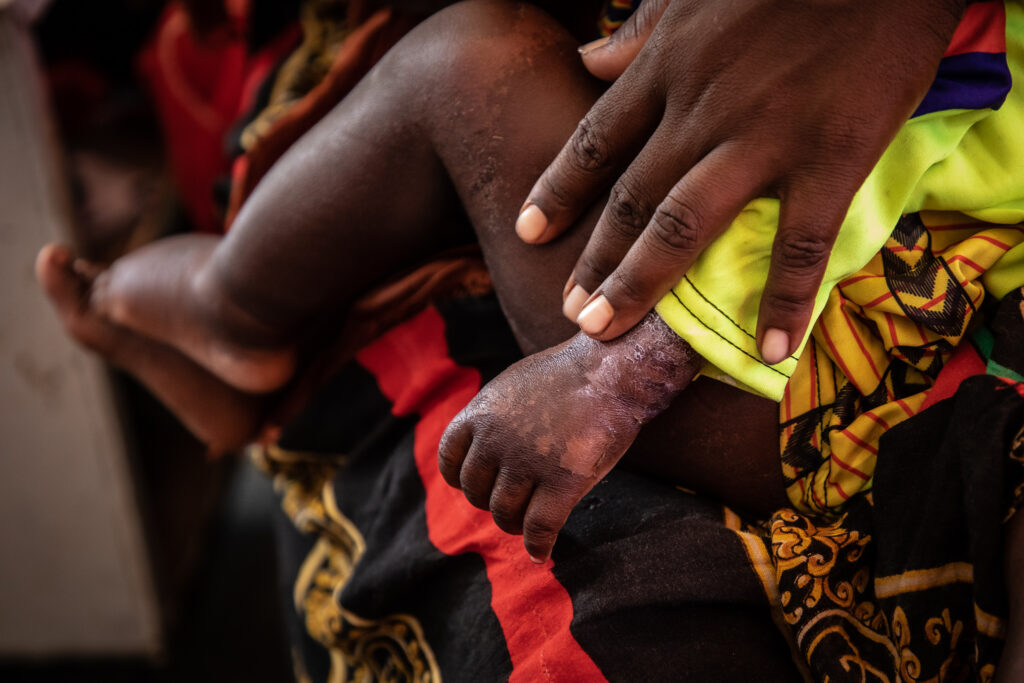 Unicef i Etiopien maj 2022